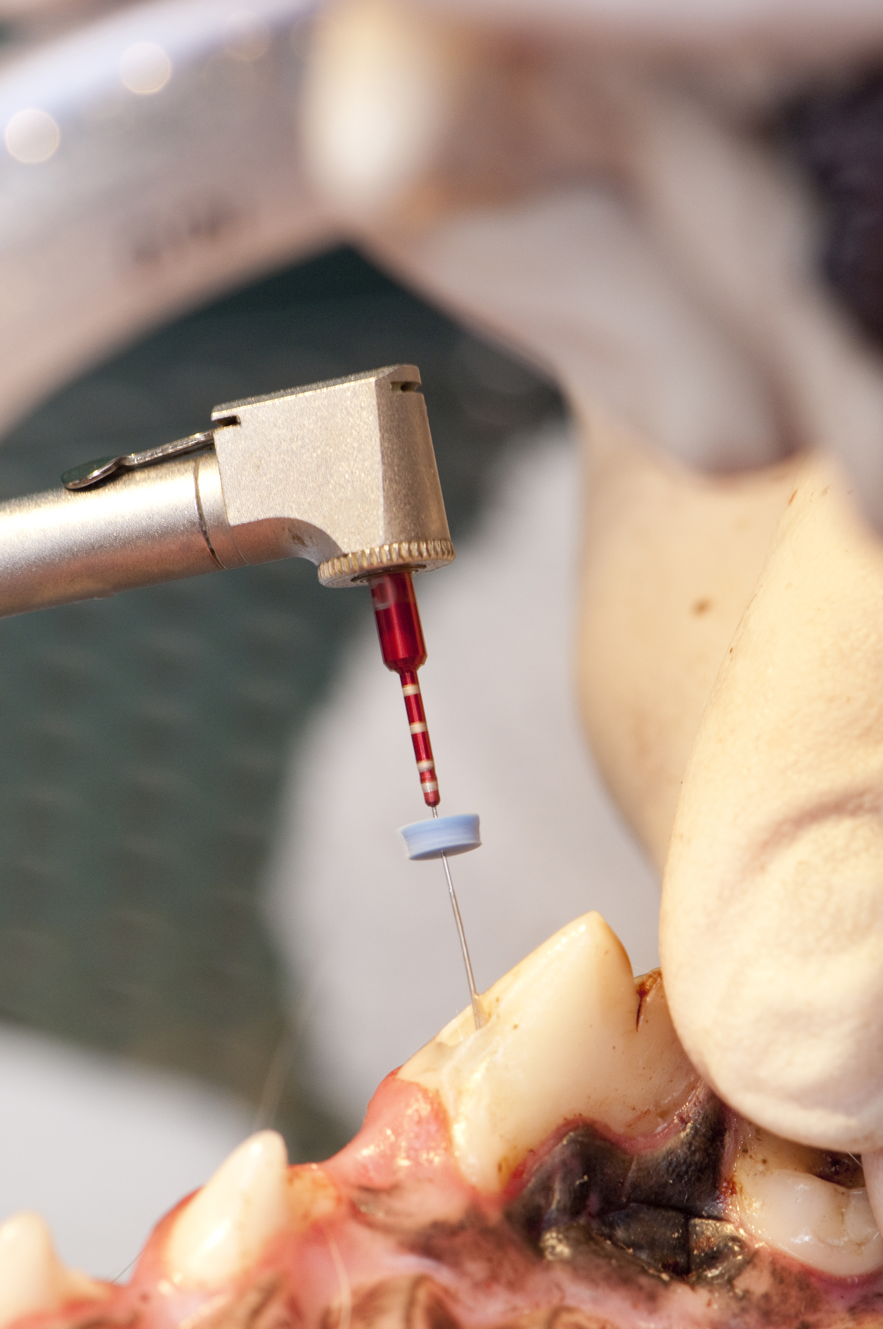 Russell Tucker drilling a tooth