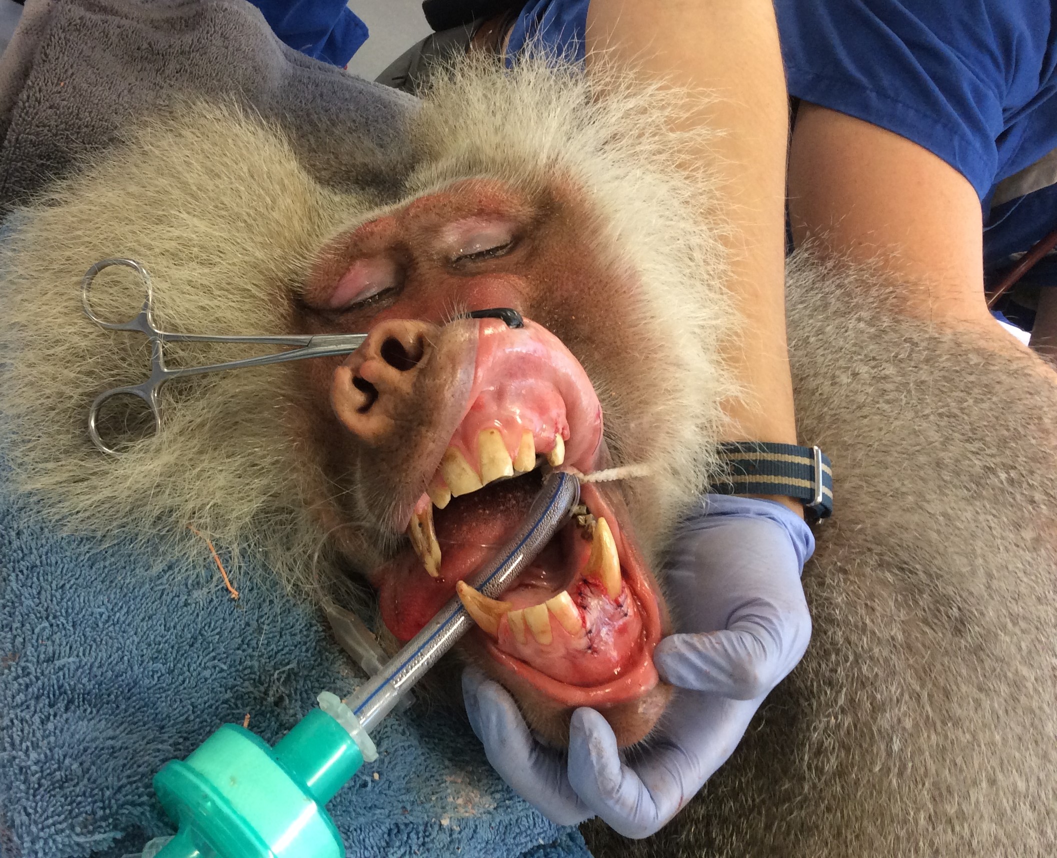 Baboon having dental surgery